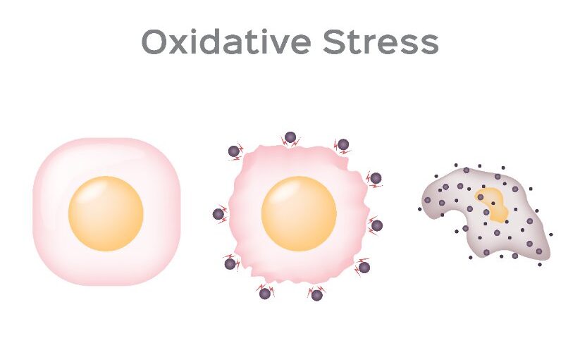 Stress Oxidatif
